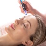 How to Prepare for Your SkinPen Microneedling Session